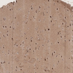 RECQL5 Antibody, Novus Biologicals 25 &mu;L | Buy Online | Novus Biologicals | Fisher Scientific