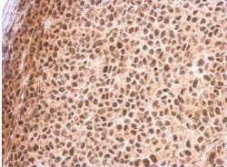 RED Antibody, Novus Biologicals 0.1mL; Unlabeled:Antibodies, Polyclonal