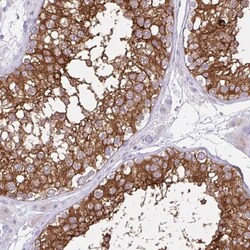 REEP1 Antibody, Novus Biologicals 0.1mL; Unlabeled:Antibodies, Polyclonal