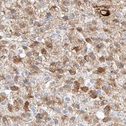 REEP2 Antibody, Novus Biologicals:Antibodies:Primary Antibodies