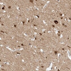 REEP2 Antibody, Novus Biologicals:Antibodies:Primary Antibodies