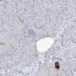REEP2 Antibody, Novus Biologicals:Antibodies:Primary Antibodies