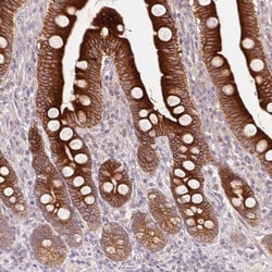 REEP6 Antibody, Novus Biologicals:Antibodies:Primary Antibodies