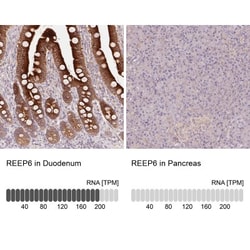 REEP6 Antibody, Novus Biologicals:Antibodies:Primary Antibodies