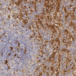 RENBP Antibody, Novus Biologicals:Antibodies:Primary Antibodies