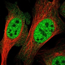 RENT1/UPF1/hUPF1 Antibody, Novus Biologicals 0.1mL; Unlabeled:Antibodies,
