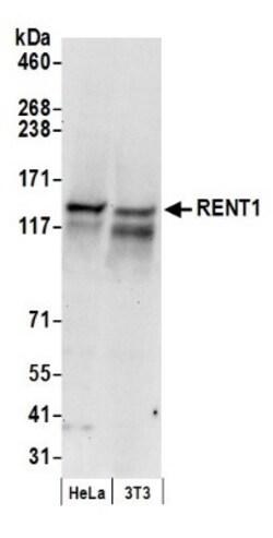 RENT1/UPF1/hUPF1 Antibody, Novus Biologicals 0.1mg; Unlabeled:Antibodies,