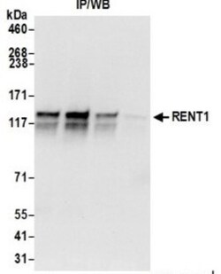 RENT1/UPF1/hUPF1 Antibody, Novus Biologicals 100 &mu;L | Buy Online | Novus Biologicals | Fisher Scientific