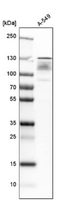 RENT1/UPF1/hUPF1 Antibody, Novus Biologicals 0.1mL; Unlabeled:Antibodies,