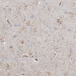 REPS2 Antibody, Novus Biologicals 0.1mL; Unlabeled:Antibodies, Polyclonal