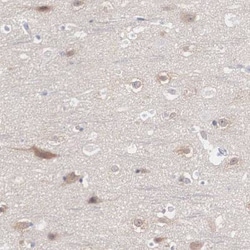 REPS2 Antibody, Novus Biologicals 0.1mL; Unlabeled:Antibodies, Polyclonal