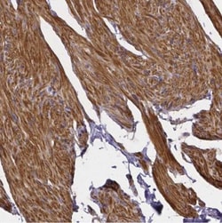 RERG Antibody, Novus Biologicals 25 &mu;L; Unlabeled:Antibodies, Polyclonal