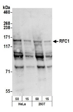 RFC1 Antibody, Novus Biologicals 0.1 mL | Buy Online | Novus Biologicals | Fisher Scientific