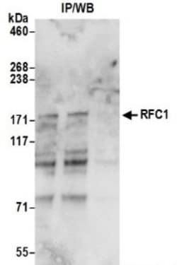 RFC1 Antibody, Novus Biologicals 0.1 mL | Buy Online | Novus Biologicals | Fisher Scientific