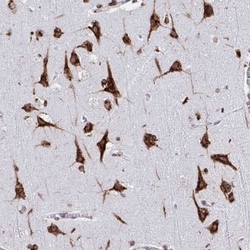 RFK Antibody, Novus Biologicals 25 &mu;L, Unlabeled:Antibodies, Polyclonal