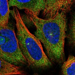 RFPL4A Antibody, Novus Biologicals 0.1mL; Unlabeled:Antibodies, Polyclonal