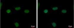 RFPL4B Antibody, Novus Biologicals 0.1mL; Unlabeled:Antibodies, Polyclonal