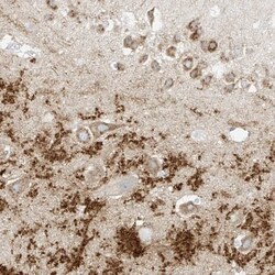 ZNF189 Antibody, Novus Biologicals:Antibodies:Primary Antibodies