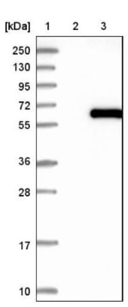 ZNF189 Antibody, Novus Biologicals:Antibodies:Primary Antibodies