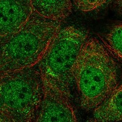RFX2 Antibody, Novus Biologicals 0.1mL; Unlabeled:Antibodies, Polyclonal