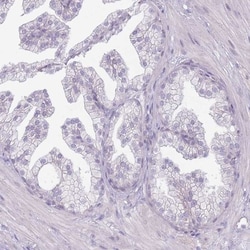 RFX2 Antibody, Novus Biologicals 0.1mL; Unlabeled:Antibodies, Polyclonal