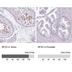 RFX2 Antibody, Novus Biologicals 0.1mL; Unlabeled:Antibodies, Polyclonal