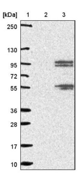 RFX2 Antibody, Novus Biologicals 0.1mL; Unlabeled:Antibodies, Polyclonal