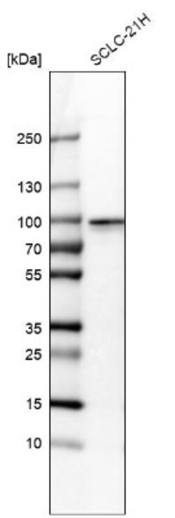 RFX2 Antibody, Novus Biologicals 0.1mL; Unlabeled:Antibodies, Polyclonal