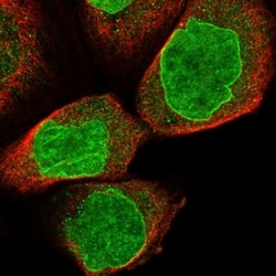 RFX7 Antibody, Novus Biologicals 25 &mu;L; Unlabeled:Antibodies, Polyclonal