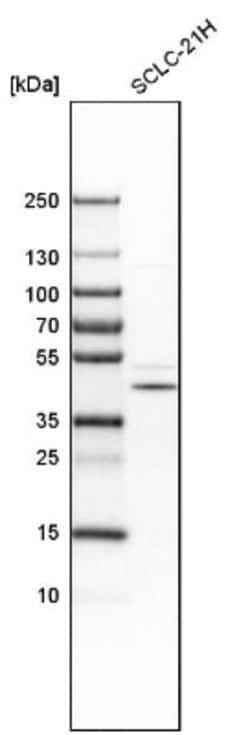 RG9MTD1 Antibody, Novus Biologicals:Antibodies:Primary Antibodies
