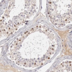 RGAG1 Antibody, Novus Biologicals 25 &mu;L; Unlabeled:Antibodies, Polyclonal