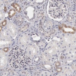 RGAG1 Antibody, Novus Biologicals 25 &mu;L; Unlabeled:Antibodies, Polyclonal