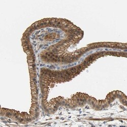 RGL1 Antibody, Novus Biologicals 0.1mL; Unlabeled:Antibodies, Polyclonal