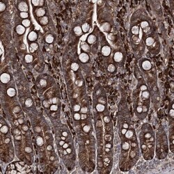 RGNEF Antibody, Novus Biologicals:Antibodies:Primary Antibodies