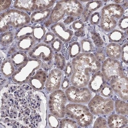 RGNEF Antibody, Novus Biologicals:Antibodies:Primary Antibodies