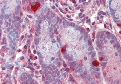 RGS1 Antibody, Novus Biologicals 0.1mg; Unlabeled:Antibodies, Polyclonal