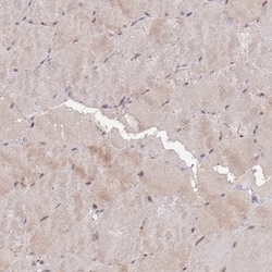 RGS14 Antibody, Novus Biologicals:Antibodies:Primary Antibodies
