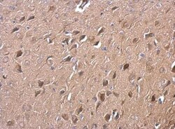 RGS14 Antibody, Novus Biologicals 0.1mL; Unlabeled:Antibodies, Polyclonal