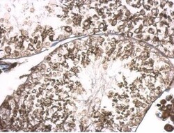 RGS14 Antibody, Novus Biologicals 0.1mL; Unlabeled:Antibodies, Polyclonal