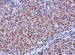 RGS2 Antibody, Novus Biologicals 100 &mu;L | Buy Online | Novus Biologicals | Fisher Scientific