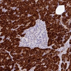 RGS21 Antibody, Novus Biologicals 25 μL, Unlabeled:Antibodies, Polyclonal