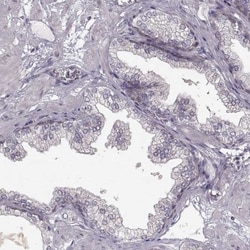 RHAMM/CD168 Antibody, Novus Biologicals:Antibodies:Primary Antibodies
