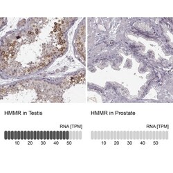 RHAMM/CD168 Antibody, Novus Biologicals:Antibodies:Primary Antibodies