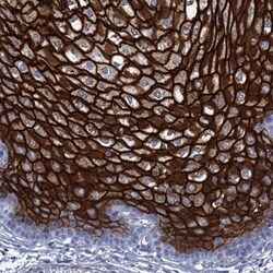 RHCG Antibody, Novus Biologicals:Antibodies:Primary Antibodies
