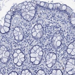 RHCG Antibody, Novus Biologicals:Antibodies:Primary Antibodies
