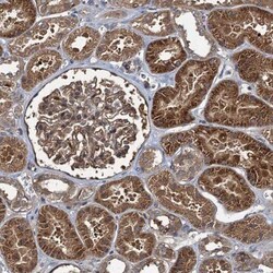 RHOBTB1 Antibody, Novus Biologicals 25 &mu;L; Unlabeled:Antibodies, Polyclonal