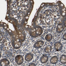 RHOT2 Antibody, Novus Biologicals 25 &mu;L; Unlabeled:Antibodies, Polyclonal