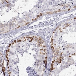RHOXF2 Antibody, Novus Biologicals 25 &mu;L | Buy Online | Novus Biologicals | Fisher Scientific