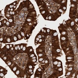 RHPN1 Antibody, Novus Biologicals 0.1mL; Unlabeled:Antibodies, Polyclonal