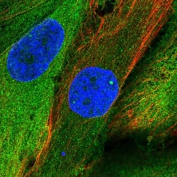RIAM/APBB1IP Antibody, Novus Biologicals 0.1mL; Unlabeled:Antibodies, Polyclonal